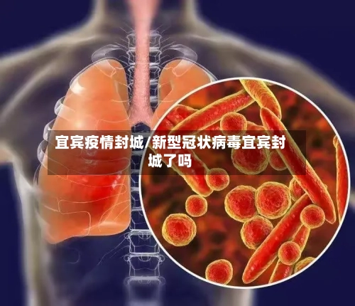 宜宾疫情封城/新型冠状病毒宜宾封城了吗